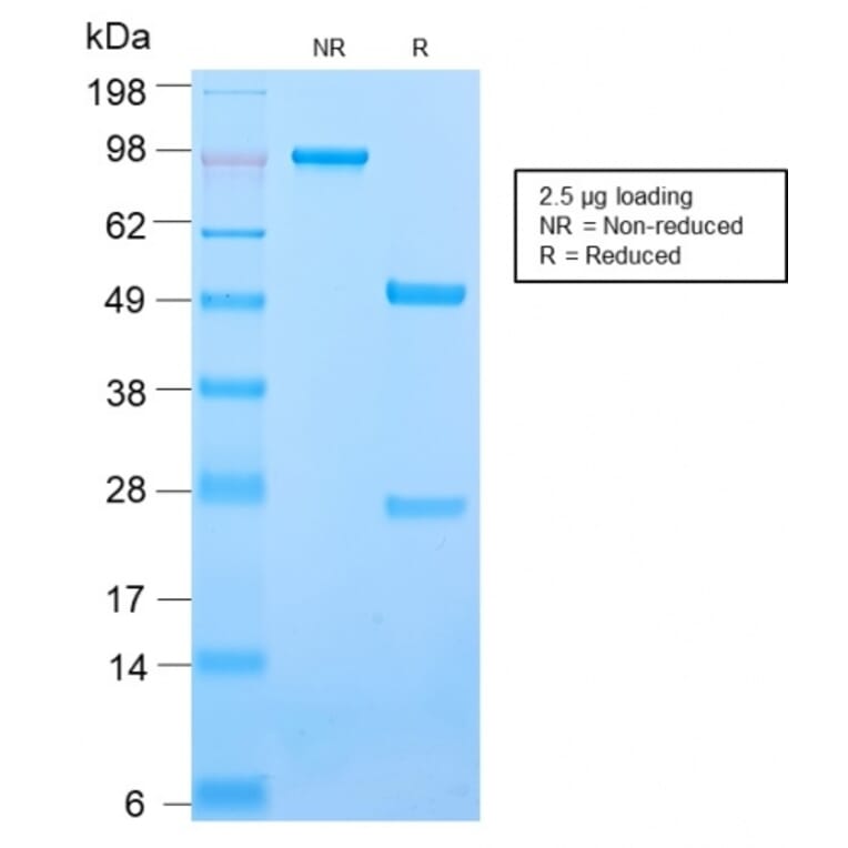 SDS-PAGE - Anti-ICAM3 Antibody [ICAM3/2873R] (A248913) - Antibodies.com