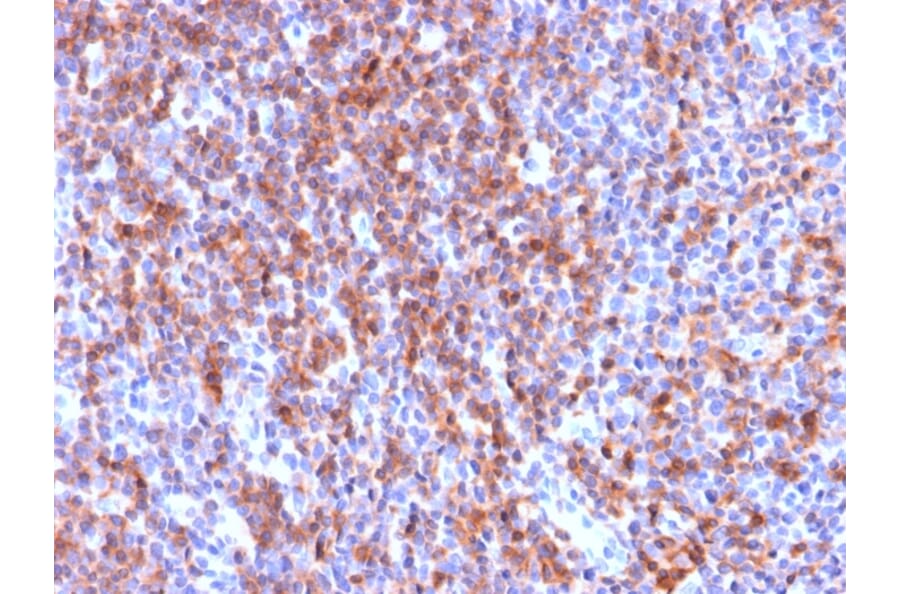 Immunohistochemistry - Anti-ICAM3 Antibody [ICAM3/2873R] (A248912) - Antibodies.com