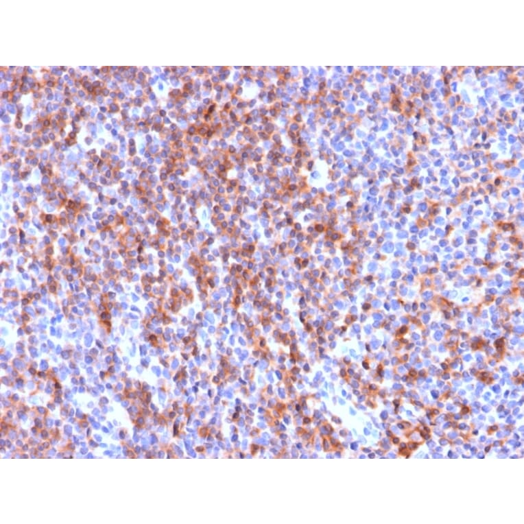 Immunohistochemistry - Anti-ICAM3 Antibody [ICAM3/2873R] (A248912) - Antibodies.com