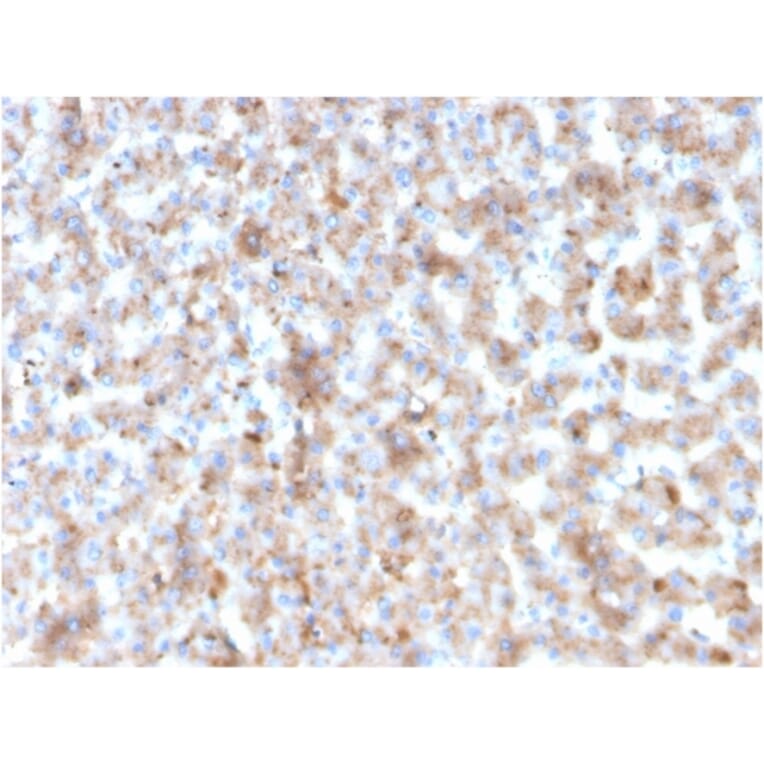 Immunohistochemistry - Anti-Apolipoprotein B Antibody [APOB/3300] (A248914) - Antibodies.com