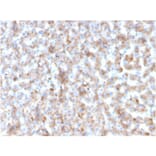 Immunohistochemistry - Anti-Apolipoprotein B Antibody [APOB/3300] (A248914) - Antibodies.com