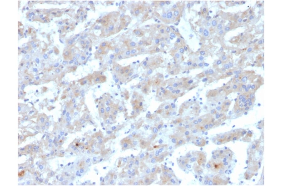 Immunohistochemistry - Anti-Apolipoprotein B Antibody [APOB/3300] (A248914) - Antibodies.com