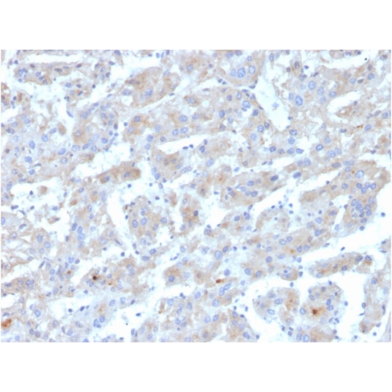 Immunohistochemistry - Anti-Apolipoprotein B Antibody [APOB/3300] (A248914) - Antibodies.com