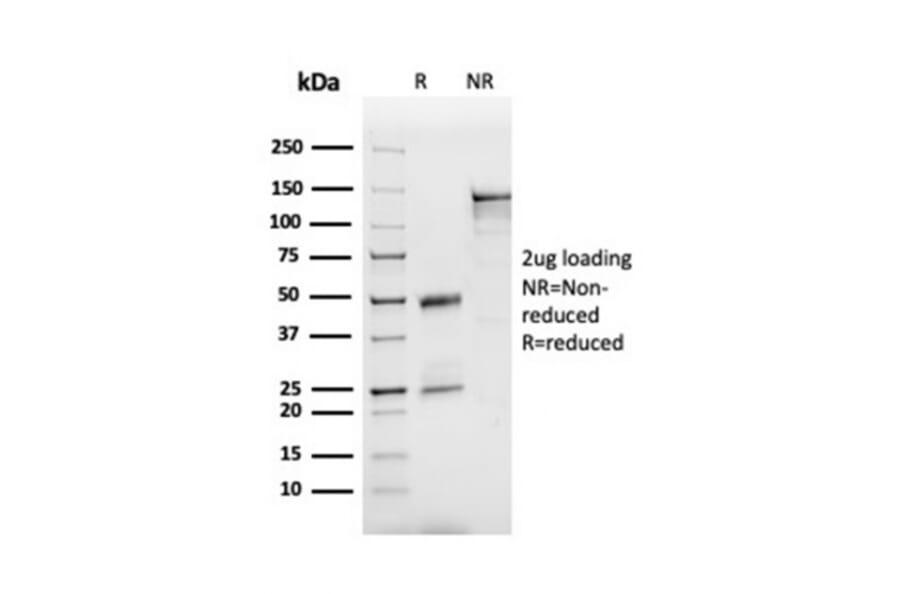 SDS-PAGE - Anti-Apolipoprotein B Antibody [APOB/3300] (A248914) - Antibodies.com