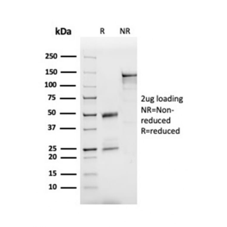 SDS-PAGE - Anti-Apolipoprotein B Antibody [APOB/3300] (A248914) - Antibodies.com