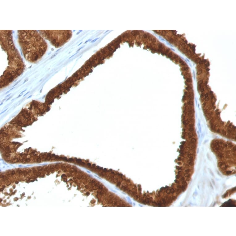 Immunohistochemistry - Anti-IDH1 Antibody [IDH1/1152] (A248915) - Antibodies.com