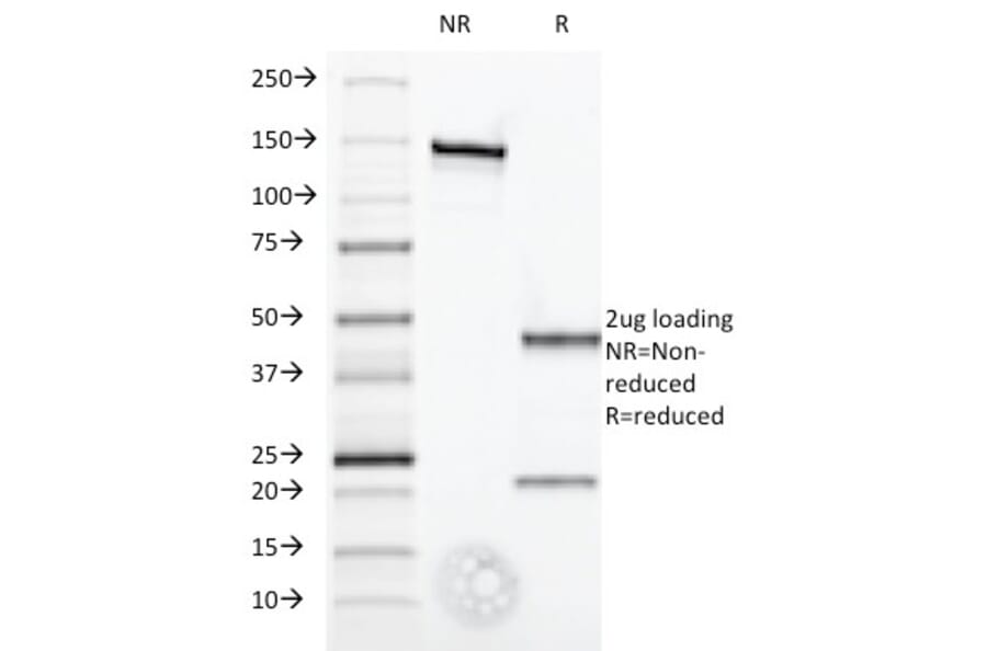 SDS-PAGE - Anti-Interferon alpha 1 Antibody [2-52] (A248917) - Antibodies.com