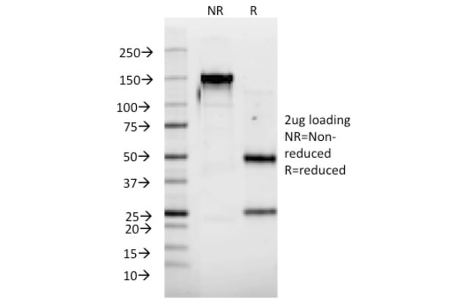 SDS-PAGE - Anti-Interferon alpha 2 Antibody [N39] (A248919) - Antibodies.com