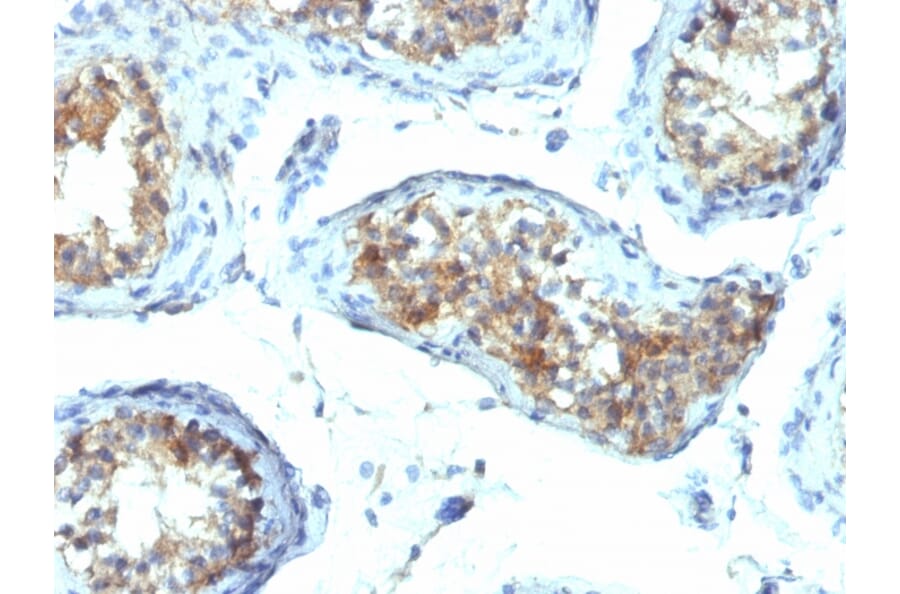 Immunohistochemistry - Anti-Interferon gamma Antibody [IFNG/466] (A248925) - Antibodies.com