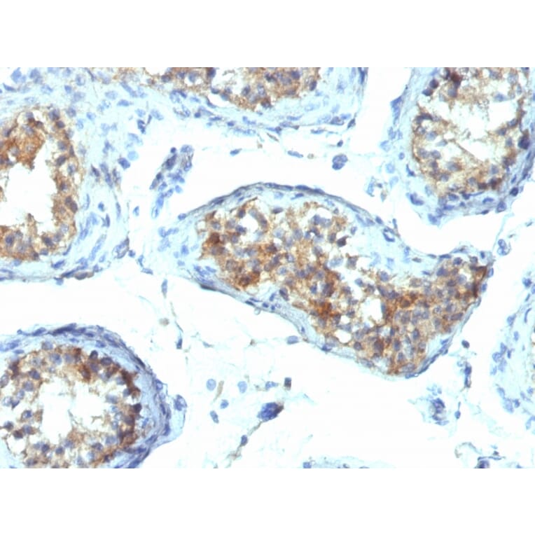 Immunohistochemistry - Anti-Interferon gamma Antibody [IFNG/466] (A248925) - Antibodies.com