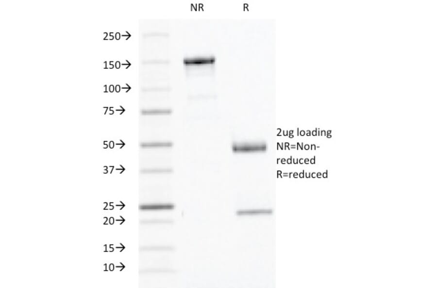 SDS-PAGE - Anti-Interferon gamma Antibody [IFNG/466] (A248925) - Antibodies.com