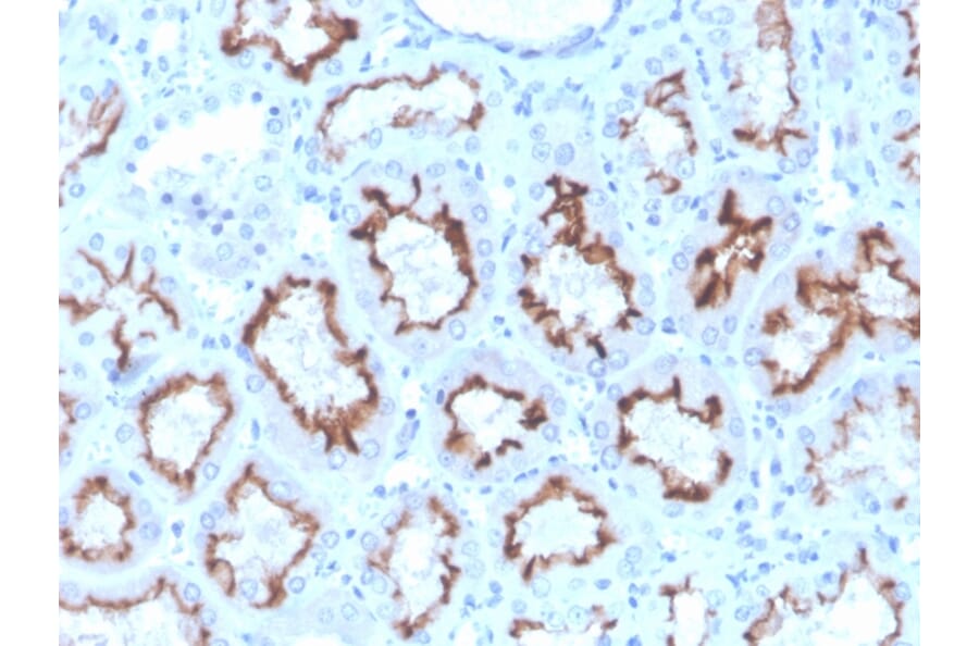 Immunohistochemistry - Anti-Interferon gamma Antibody [rIFNG/4467] (A248925) - Antibodies.com