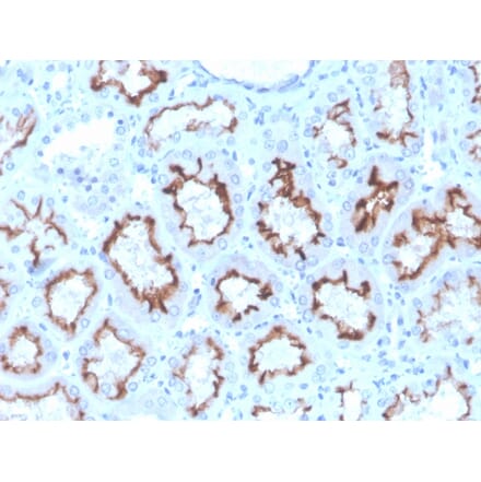 Immunohistochemistry - Anti-Interferon gamma Antibody [rIFNG/4467] (A248925) - Antibodies.com