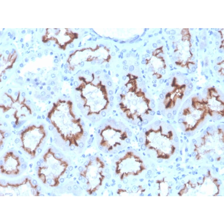 Immunohistochemistry - Anti-Interferon gamma Antibody [rIFNG/4467] (A248925) - Antibodies.com