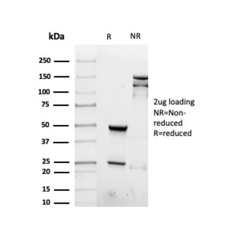 SDS-PAGE - Anti-Interferon gamma Antibody [rIFNG/4467] (A248927) - Antibodies.com