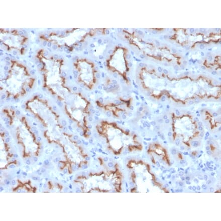 Immunohistochemistry - Anti-Interferon gamma Antibody [IFNG/3996R] (A248928) - Antibodies.com