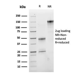 SDS-PAGE - Anti-IGF1 Antibody [M23] (A248928) - Antibodies.com