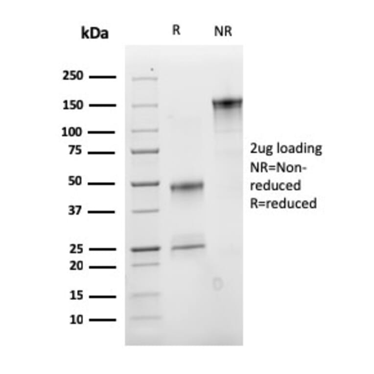 SDS-PAGE - Anti-IGF1 Antibody [M23] (A248928) - Antibodies.com