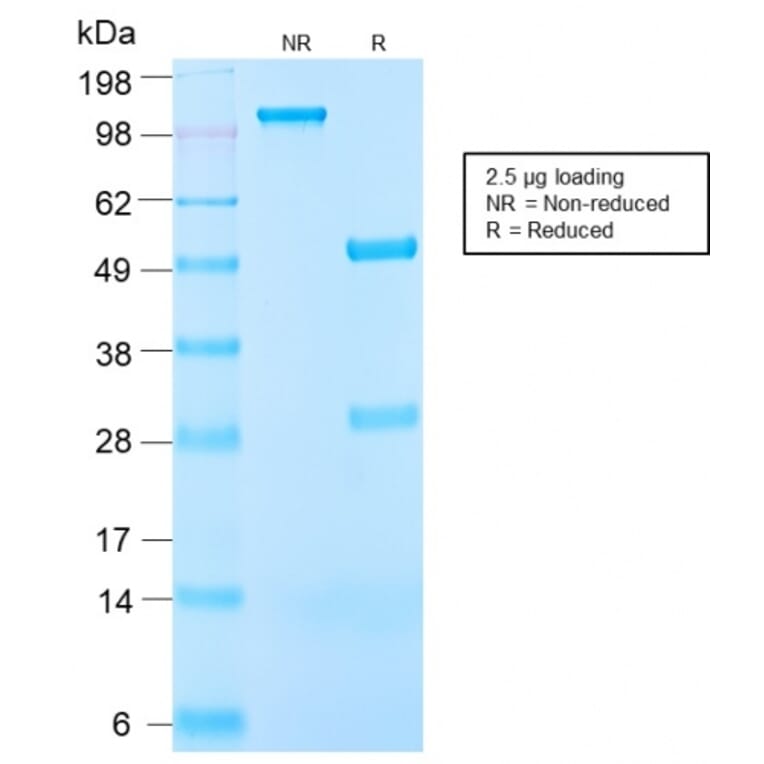 SDS-PAGE - Anti-IGF1 Antibody [IGF1/2872R] (A248932) - Antibodies.com