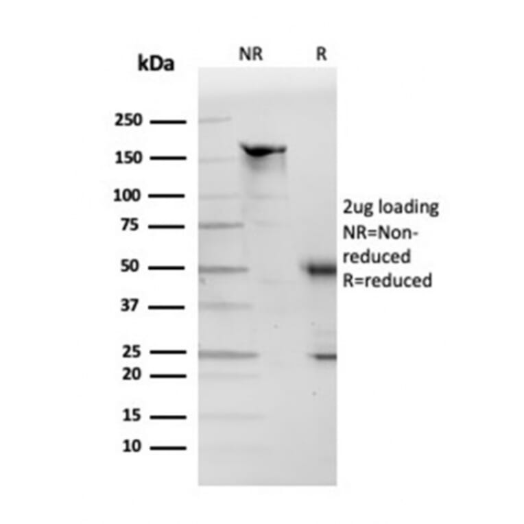 SDS-PAGE - Anti-Apolipoprotein D Antibody [APOD/3412] (A248933) - Antibodies.com