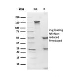 SDS-PAGE - Anti-Apolipoprotein D Antibody [APOD/3414] (A248934) - Antibodies.com