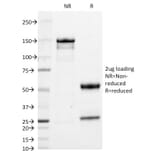 SDS-PAGE - Anti-Human IgA Heavy Chain Antibody [HISA43] (A248935) - Antibodies.com