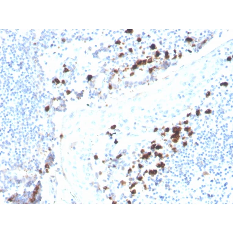 Immunohistochemistry - Anti-Human IgA Heavy Chain Antibody [rHISA43] (A248935) - Antibodies.com