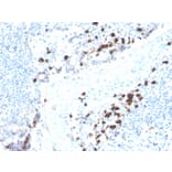 Immunohistochemistry - Anti-Human IgA Heavy Chain Antibody [rHISA43] (A248935) - Antibodies.com
