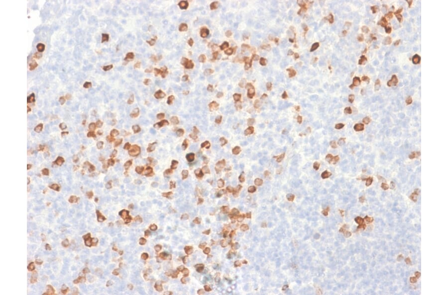 Immunohistochemistry - Anti-Human IgG Heavy Chain Antibody [rIG266] (A252127) - Antibodies.com