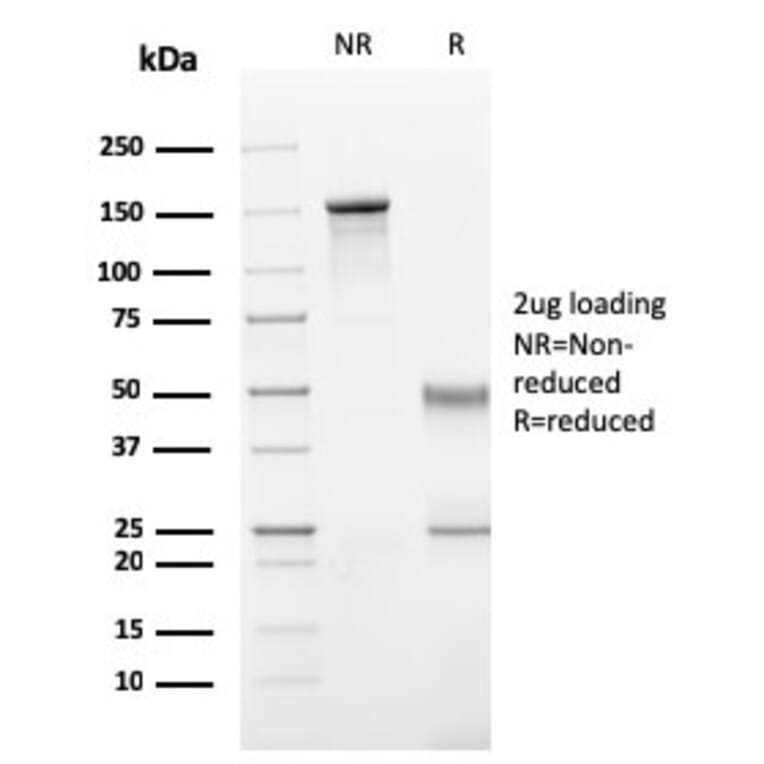 SDS-PAGE - Anti-Human IgG Heavy Chain Antibody [rIG266] (A252127) - Antibodies.com
