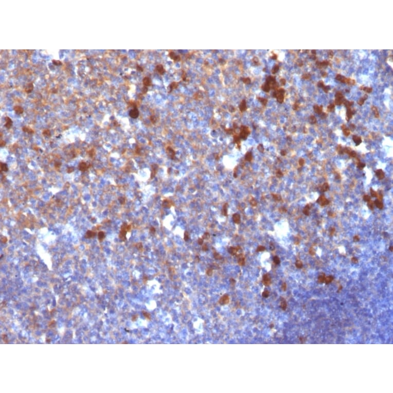 Immunohistochemistry - Anti-Human IgG Heavy Chain Antibody [IG217] (A248940) - Antibodies.com
