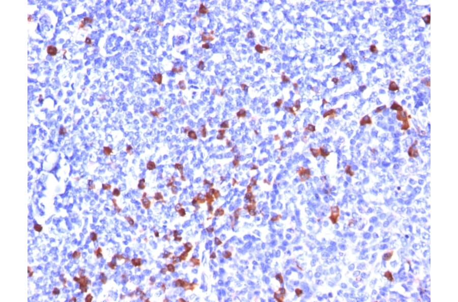 Immunohistochemistry - Anti-Human IgG Heavy Chain Antibody [SPM556] (A248942) - Antibodies.com