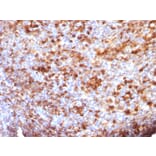 Immunohistochemistry - Anti-Human IgG Heavy Chain Antibody [B33/20] (A252118) - Antibodies.com