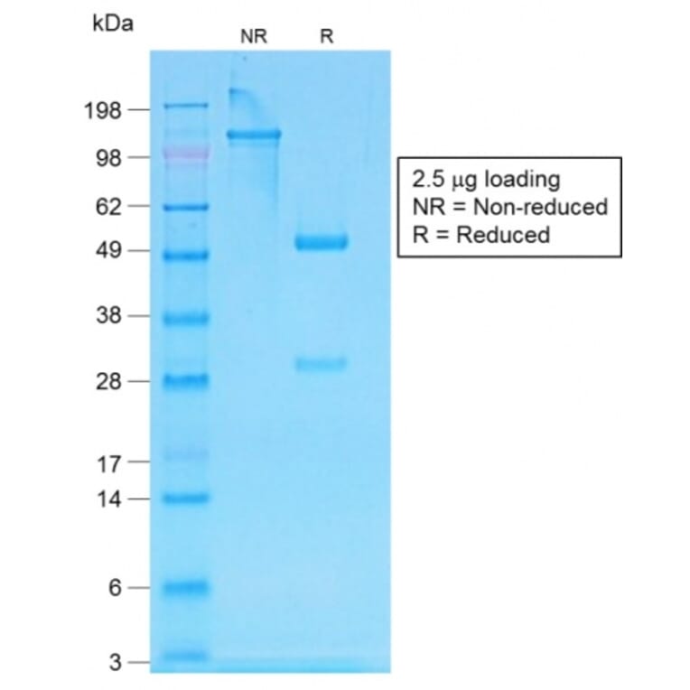 SDS-PAGE - Anti-Human IgG Heavy Chain Antibody [IG507R] (A248947) - Antibodies.com