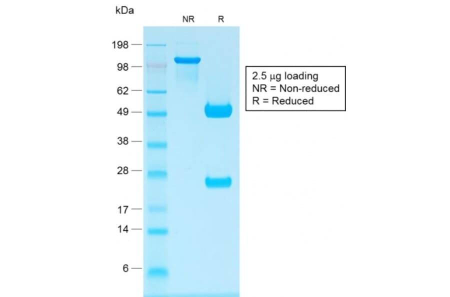 SDS-PAGE - Anti-Human IgG Heavy Chain Antibody [IG1707R] (A252119) - Antibodies.com