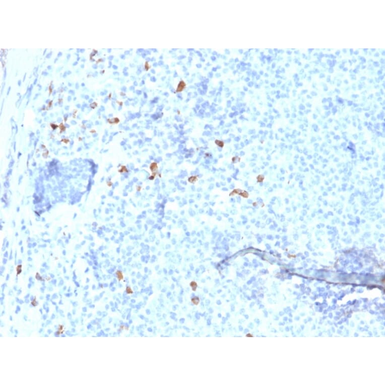 Immunohistochemistry - Anti-Human IgG4 Heavy Chain Antibody [IGHG4/1345] (A248949) - Antibodies.com