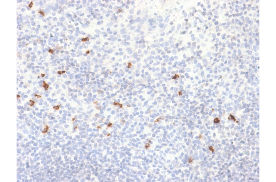 Immunohistochemistry - Anti-Human IgG4 Heavy Chain Antibody [IGHG4/2042R] (A248952) - Antibodies.com