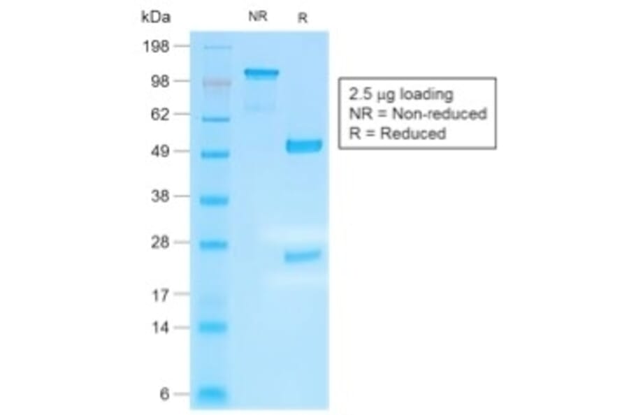 SDS-PAGE - Anti-Human IgG4 Heavy Chain Antibody [IGHG4/2042R] (A248952) - Antibodies.com