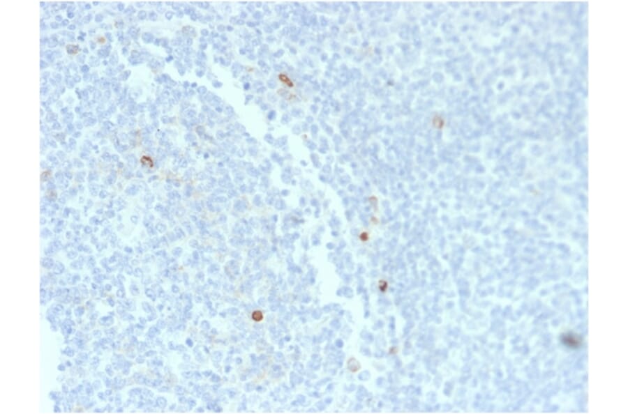 Immunohistochemistry - Anti-Human IgM Heavy Chain Antibody [rIM373] (A252134) - Antibodies.com