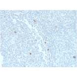 Immunohistochemistry - Anti-Human IgM Heavy Chain Antibody [rIM373] (A252134) - Antibodies.com