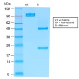 SDS-PAGE - Anti-Human IgM Heavy Chain Antibody [rIM373] (A252134) - Antibodies.com