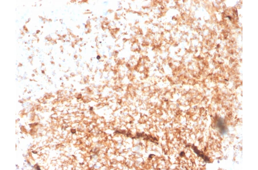 Immunohistochemistry - Anti-Human IgM Heavy Chain Antibody [rIGHM/3802] (A248954) - Antibodies.com