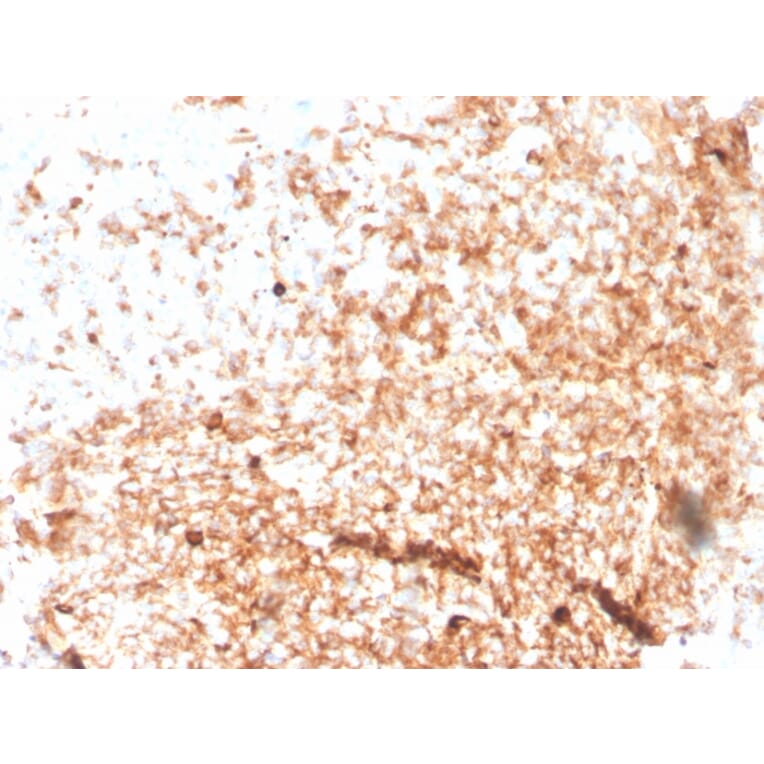Immunohistochemistry - Anti-Human IgM Heavy Chain Antibody [rIGHM/3802] (A248954) - Antibodies.com