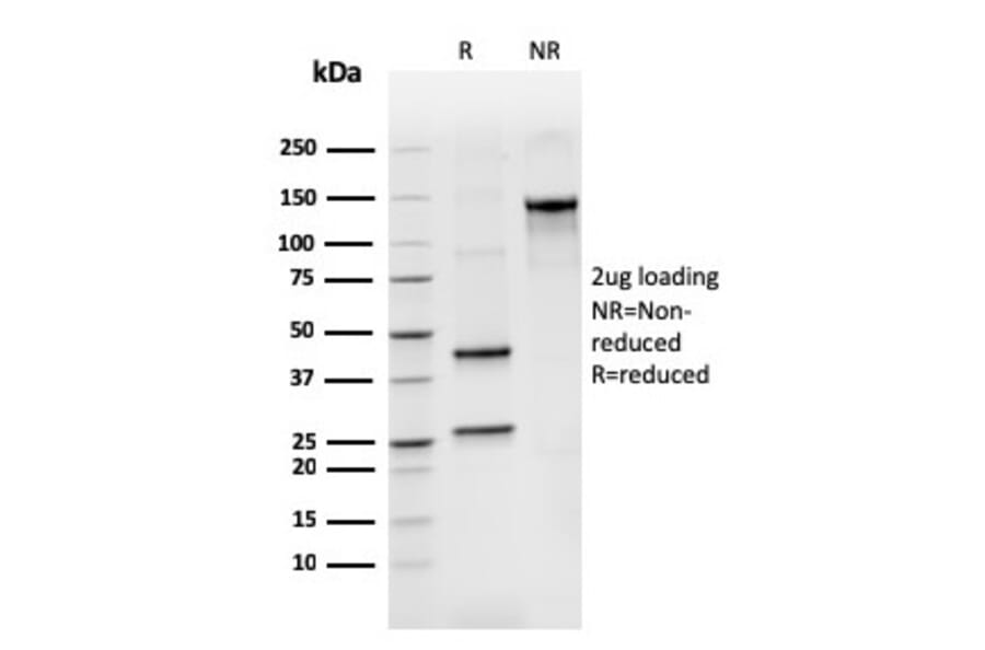SDS-PAGE - Anti-Human IgM Heavy Chain Antibody [rIGHM/3802] (A248955) - Antibodies.com