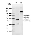 SDS-PAGE - Anti-Human IgM Heavy Chain Antibody [rIGHM/3802] (A248955) - Antibodies.com