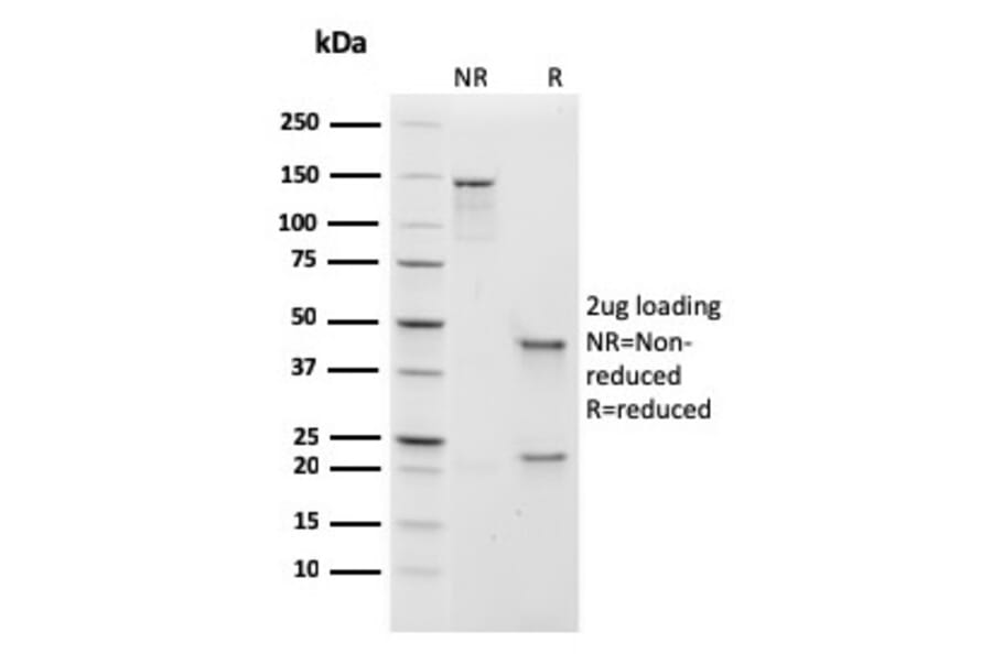 SDS-PAGE - Anti-Human IgM Heavy Chain Antibody [rIGHM/1623] (A248956) - Antibodies.com
