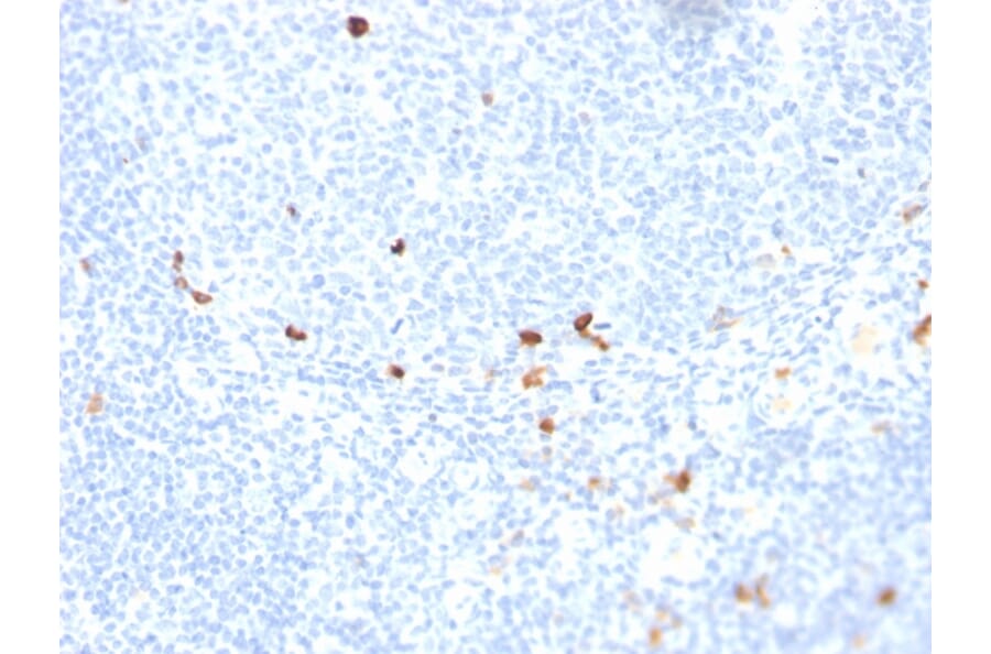Immunohistochemistry - Anti-Human IgM Heavy Chain Antibody [rIGHM/1623] (A248955) - Antibodies.com