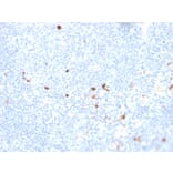 Immunohistochemistry - Anti-Human IgM Heavy Chain Antibody [rIGHM/1623] (A248955) - Antibodies.com