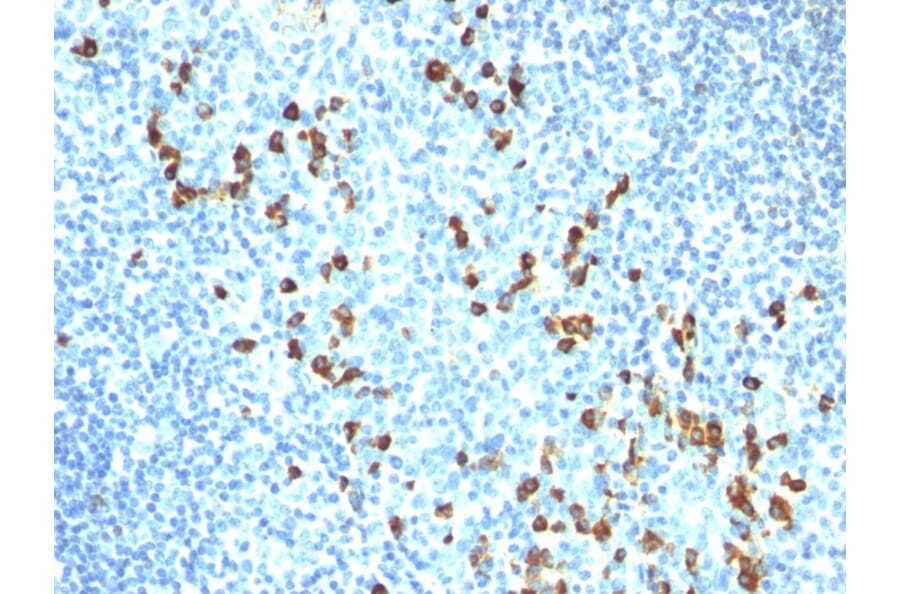 Immunohistochemistry - Anti-Human IgM Heavy Chain Antibody [ICO-30] (A248956) - Antibodies.com