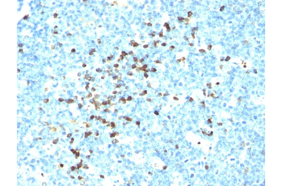 Immunohistochemistry - Anti-Human IgM Heavy Chain Antibody [DA4-4] (A252143) - Antibodies.com